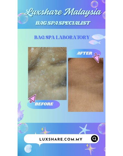 LOUIS VUITTON SPEEDY 30 IN MONOGRAM CANVAS (BAG SPA CLEANING, REMOVE MOULD)